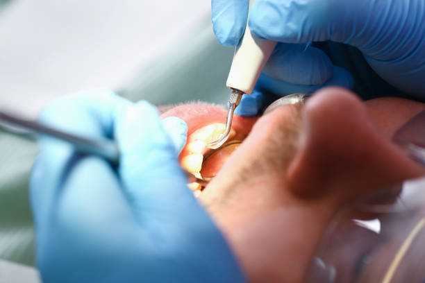 Best Cosmetic Emergency Dentistry in Lafayette, GA