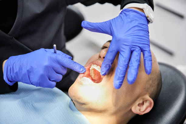 Best Emergency Tooth Extraction in Lafayette, GA